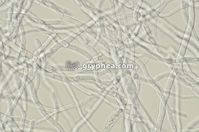 Hyphes et mycélium de Penicillium notatum x160 - gryphea.com